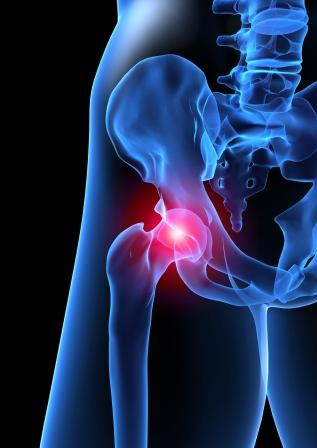 eau-claire-chiropractor-hip-pain.jpg