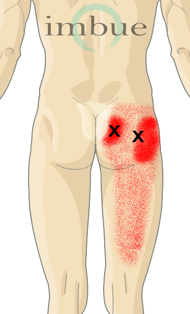 Piriformis.png