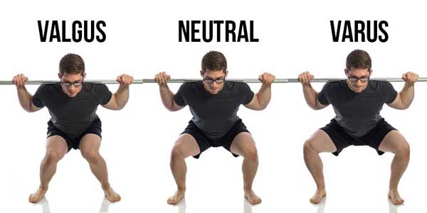 valgus-varus.jpg