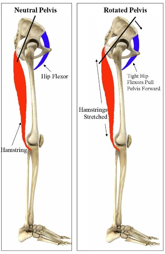 tight-hip-flexors.jpg