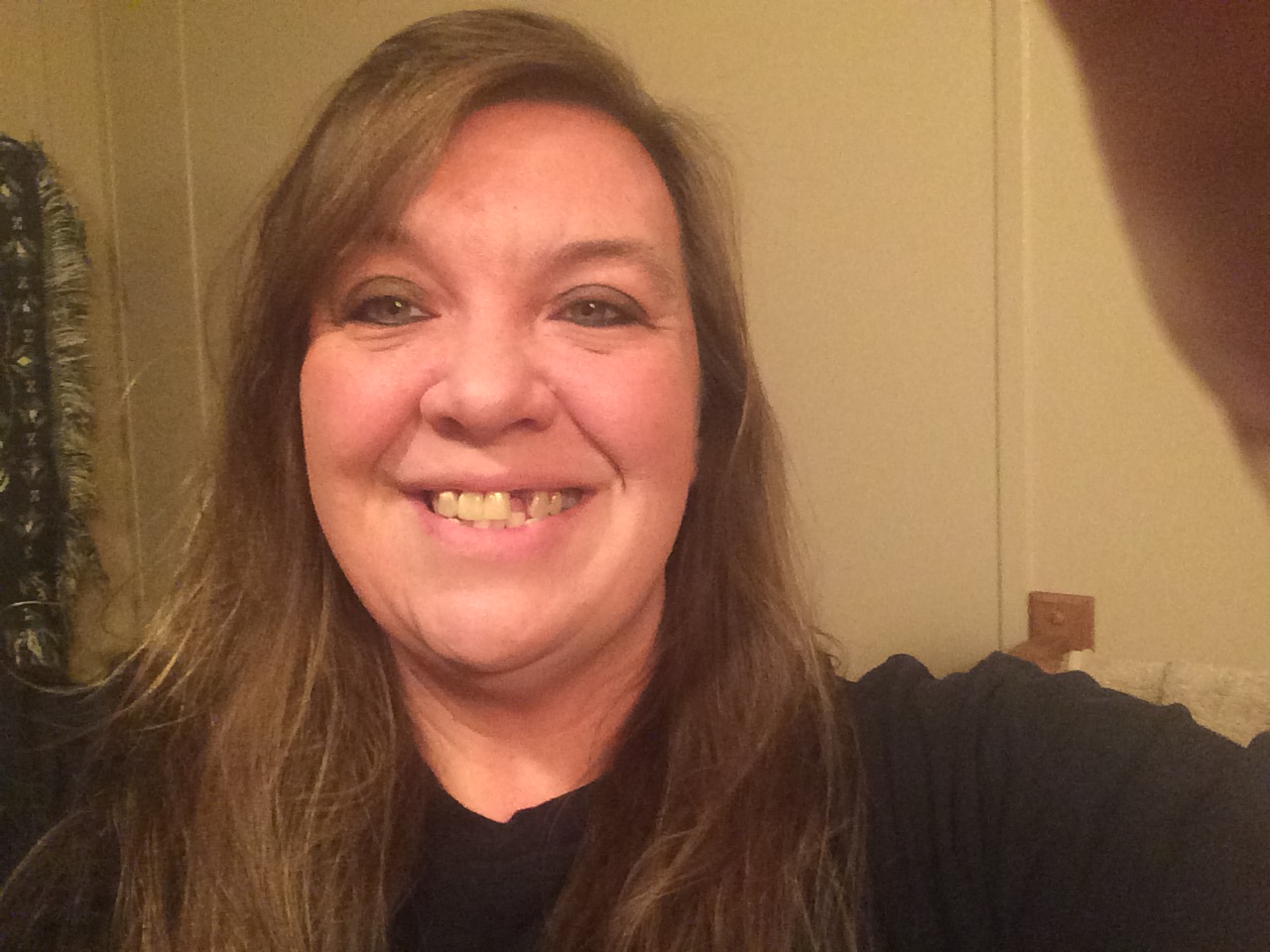 My-ugly-smile.jpg